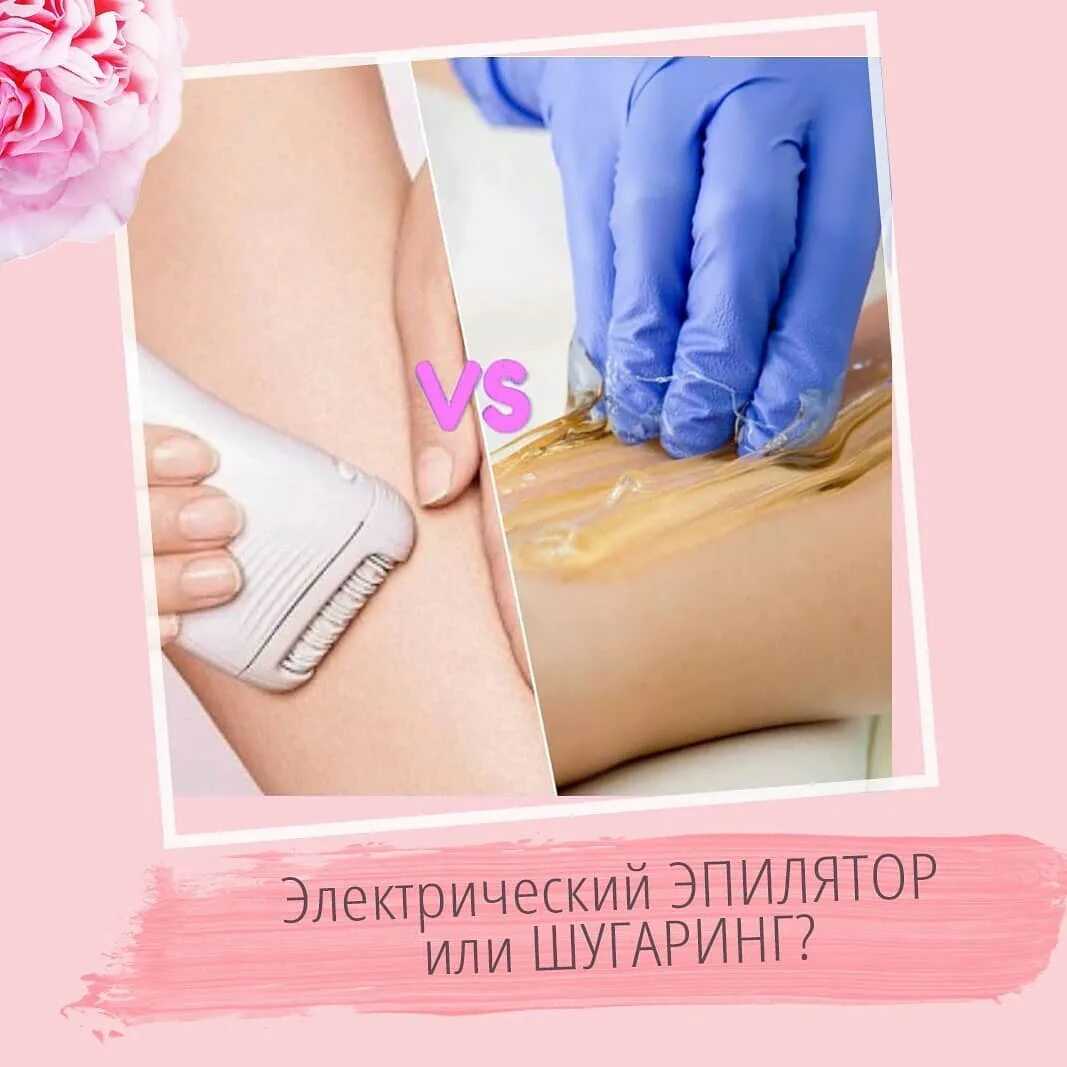 Удаление волос навсегда в домашних условиях - популярные методы
